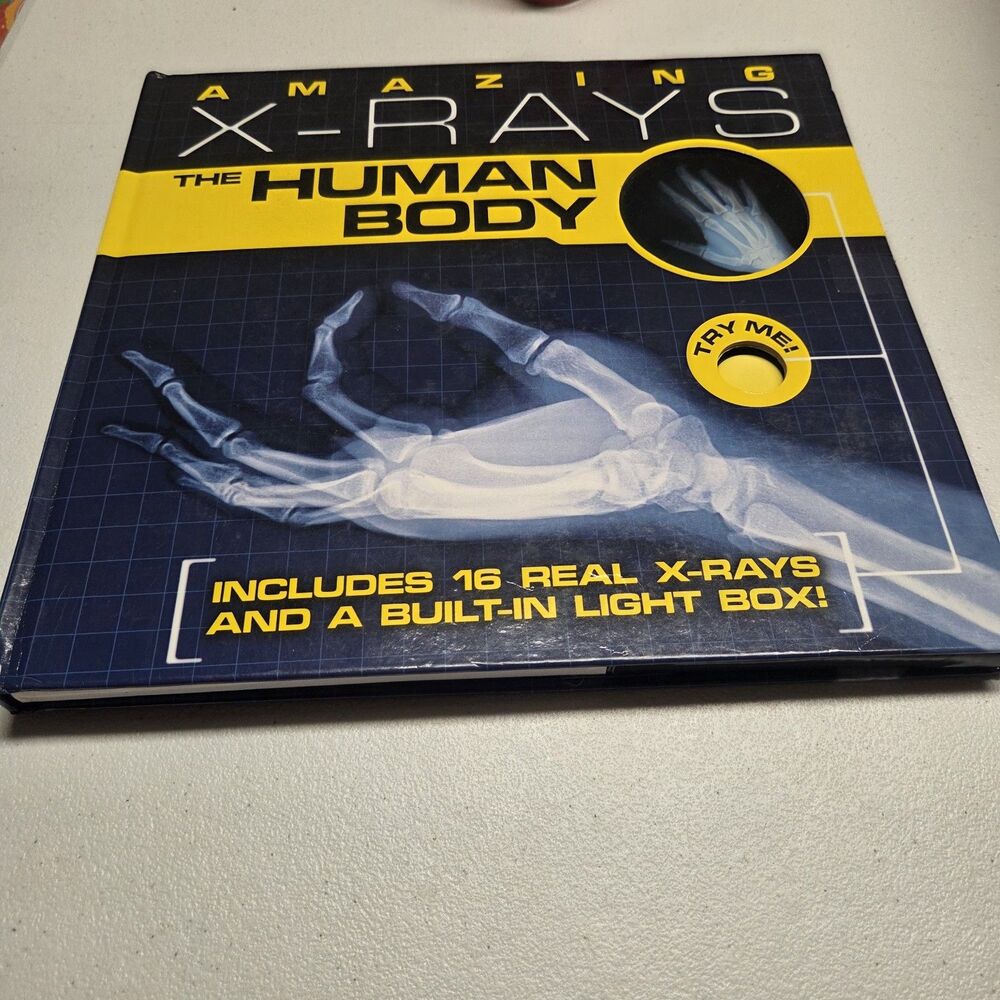 Amazing X-Rays The Human Body by Paul Beck Hardcover Book With X Rays & Lightbox